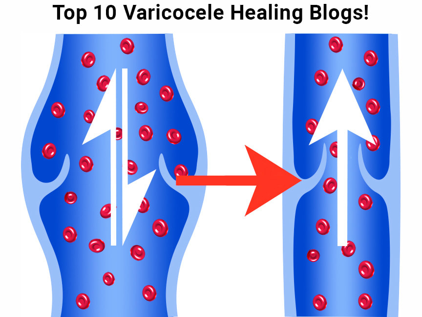 Varicocele Healing - Varicocele Natural Treatment Without Surgery